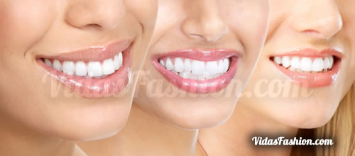 5 consejos para tener dientes blancos remedio